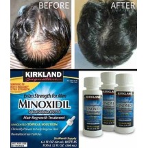 Minoxidil Tonico de Crescimento Capilar Barba Queda Cabelo Kirkland 360g